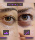 کرم سفت کننده دور چشم و لب وایپر
